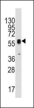 ANTI-ECGF1 (CENTER) antibody produced in rabbit affinity isolated antibody, buffered aqueous solution