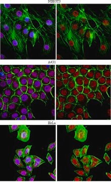 Anti-U1-70K Antibody from rabbit