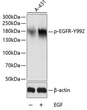 Anti-Phospho-EGFR-Y992 antibody produced in rabbit