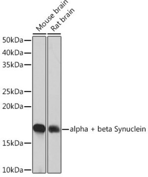 Anti-alpha + beta Synuclein Antibody, clone 9E9X5, Rabbit Monoclonal