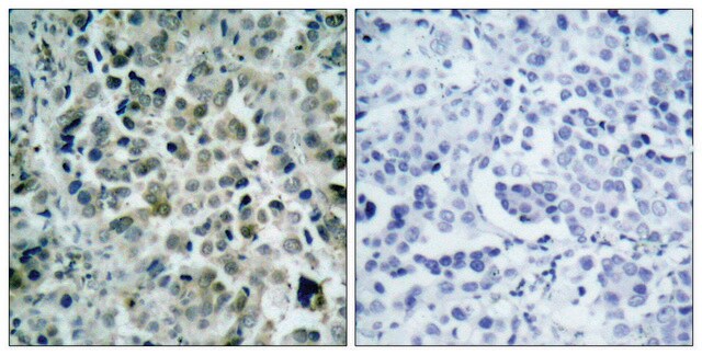 Anti-HDAC8 antibody produced in rabbit affinity isolated antibody