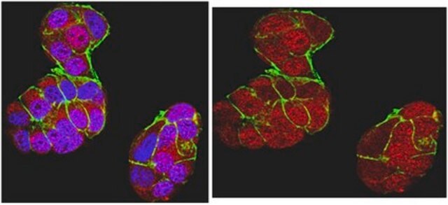 Anticorpo anti-BRCA1, clone MS110 clone MS110, from mouse