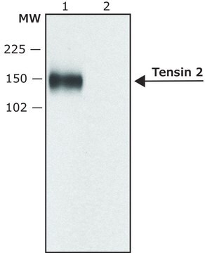 Anti-Tensin 2 antibody produced in rabbit ~0.5&#160;mg/mL, affinity isolated antibody