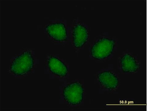 Anti-C1ORF164 antibody produced in mouse purified immunoglobulin, buffered aqueous solution