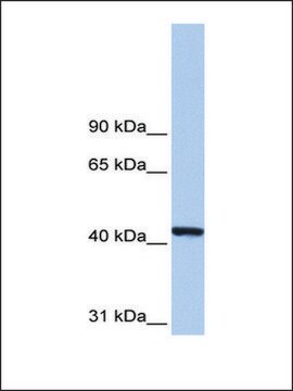 Anti-PGK1 (AB1) antibody produced in rabbit affinity isolated antibody