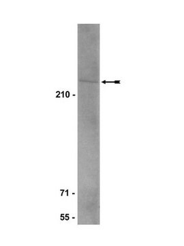 Anti-BRCA2 Antibody, clone 5.23 clone 5.23, Upstate&#174;, from mouse