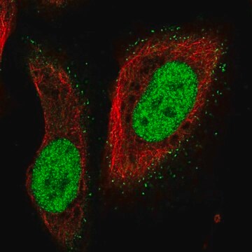 Anty-PMS2 Prestige Antibodies&#174; Powered by Atlas Antibodies, affinity isolated antibody