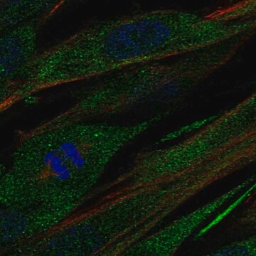 Anti-COL21A1 antibody produced in rabbit Prestige Antibodies&#174; Powered by Atlas Antibodies, affinity isolated antibody, buffered aqueous glycerol solution, ab2