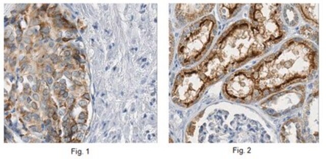 Anti-MAP17 Antibody, clone 165C clone 165C, from mouse