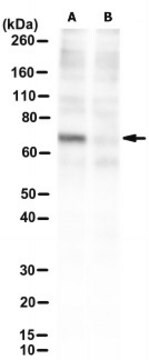 Anti-METTL3 Antibody, clone 29C8