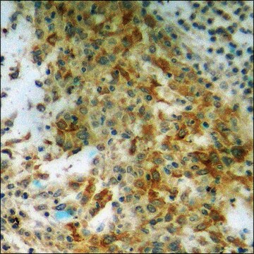 Anti-phospho-S6 Ribosomal Protein (pSer240) antibody produced in rabbit affinity isolated antibody