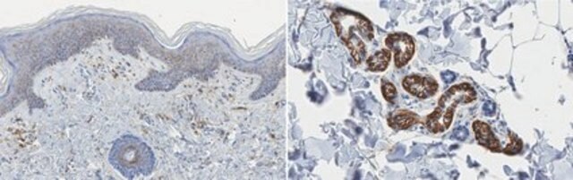 Anti-CD44 Antibody, clone Hermes-1 clone Hermes-1, from rat