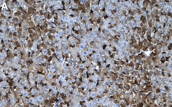 Anti-C1QA Antibody, clone 1M12 ZooMAb&#174; Rabbit Monoclonal recombinant, expressed in HEK 293 cells