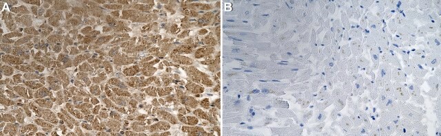 Anti-Mitochondria Antibody, clone 113-1 ZooMAb&#174; Mouse Monoclonal recombinant, expressed in HEK 293 cells