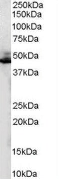 抗ADRB2R/ADRB2抗体 ヤギ宿主抗体 affinity isolated antibody, buffered aqueous solution