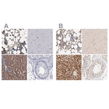 抗PYGL ウサギ宿主抗体 Prestige Antibodies&#174; Powered by Atlas Antibodies, affinity isolated antibody, buffered aqueous glycerol solution