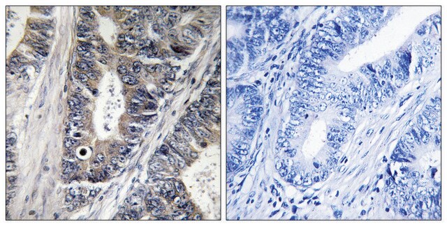 Anti-MAP3K9 antibody produced in rabbit affinity isolated antibody