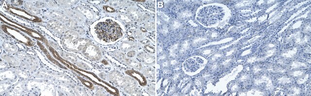 Anti-GSDMC Antibody, clone 2H7 ZooMAb&#174; Rabbit Monoclonal recombinant, expressed in HEK 293 cells