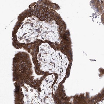 抗-EIF3M 兔抗 Prestige Antibodies&#174; Powered by Atlas Antibodies, affinity isolated antibody, buffered aqueous glycerol solution