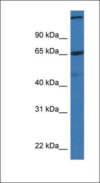 抗ST6GALNAC1抗体 ウサギ宿主抗体 affinity isolated antibody