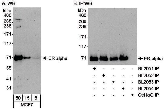 Rabbit anti-Estrogen Receptor Alpha Antibody, Affinity Purified Powered by Bethyl Laboratories, Inc.