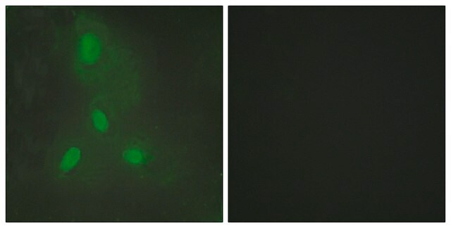 Anti-BACH1 antibody produced in rabbit affinity isolated antibody