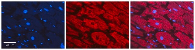 Anti-SF3B1 (AB2) antibody produced in rabbit IgG fraction of antiserum