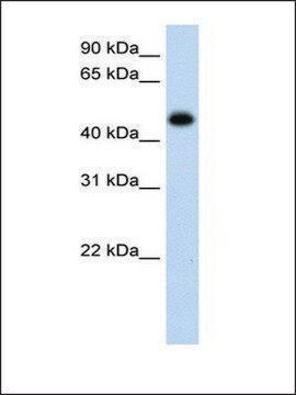 Anti-HAO1 antibody produced in rabbit affinity isolated antibody