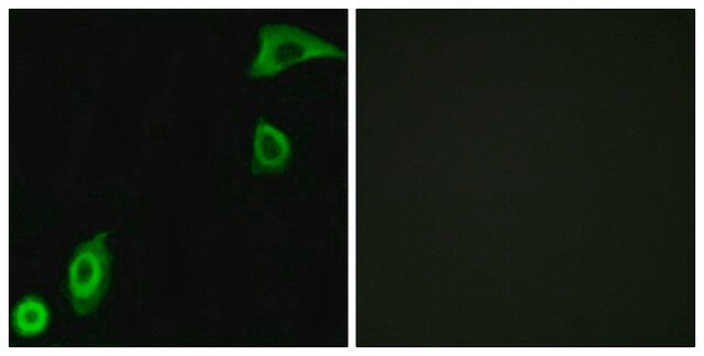 Anti-RPS20 antibody produced in rabbit affinity isolated antibody