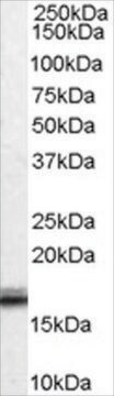 Anti-VHL antibody produced in goat affinity isolated antibody, buffered aqueous solution