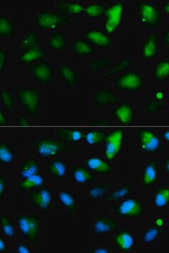 Anti-F11R antibody produced in rabbit