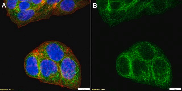 Anti-Cytokeratin 8 Antibody, clone TROMA-1 ZooMAb&#174; Rat Monoclonal recombinant, expressed in HEK 293 cells