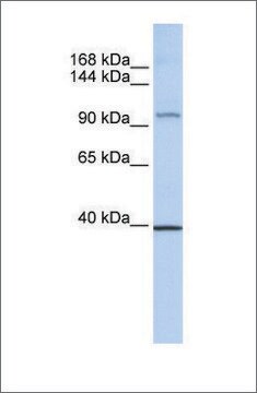 Anti-REST affinity isolated antibody