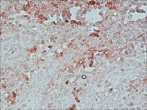 抗ニワトリIgY (IgG) (全分子)&#8722;ペルオキシダーゼ ウサギ宿主抗体 IgG fraction of antiserum, buffered aqueous solution