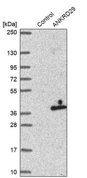 Anti-ANKRD29 antibody produced in rabbit Prestige Antibodies&#174; Powered by Atlas Antibodies, affinity isolated antibody, buffered aqueous glycerol solution