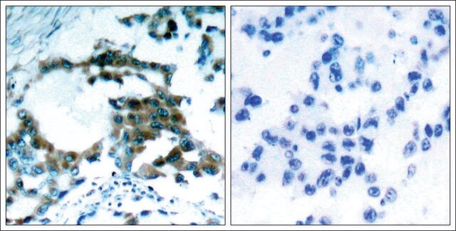 Anti-phospho-PRKCQ (pSer695) antibody produced in rabbit affinity isolated antibody