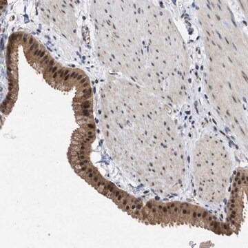 Anti-MKNK2 antibody produced in rabbit Prestige Antibodies&#174; Powered by Atlas Antibodies, affinity isolated antibody, buffered aqueous glycerol solution