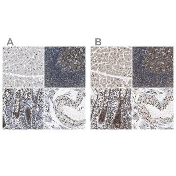 Anti-USP28 antibody produced in rabbit Ab1, Prestige Antibodies&#174; Powered by Atlas Antibodies, affinity isolated antibody, buffered aqueous glycerol solution