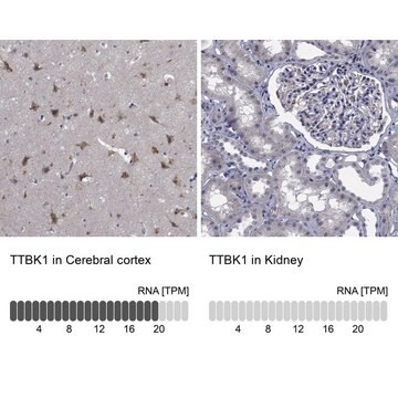 Anti-TTBK1 antibody produced in rabbit Prestige Antibodies&#174; Powered by Atlas Antibodies, affinity isolated antibody, buffered aqueous glycerol solution