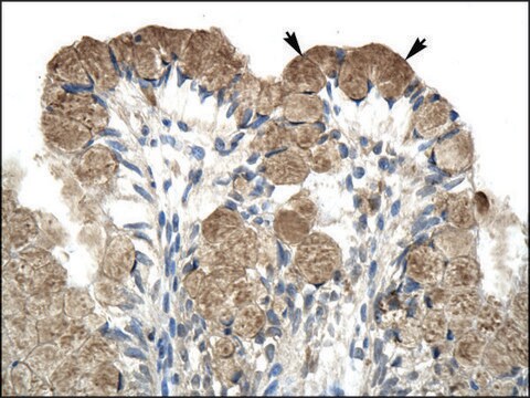 Anti-NCOR1 antibody produced in rabbit affinity isolated antibody