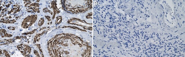 Anti-&#945; Actin 2 Antibody, clone 1C22 ZooMAb&#174; Rabbit Monoclonal recombinant, expressed in HEK 293 cells