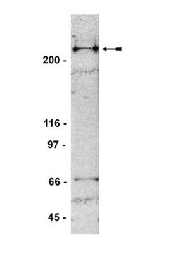 Przeciwciało anty-53BP1, klon BP13 clone BP13, Upstate&#174;, from mouse