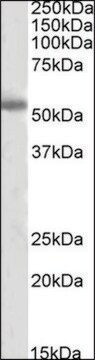 抗 TH（C 端） 山羊抗 affinity isolated antibody, buffered aqueous solution