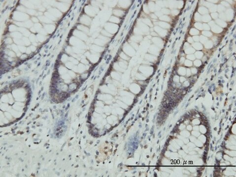 Monoclonal Anti-CLIC1 antibody produced in mouse clone 2D4, purified immunoglobulin, buffered aqueous solution