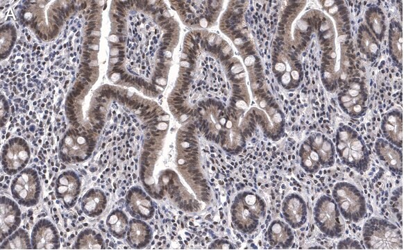 Anti-ATM Antibody, clone 4N19, ZooMAb&#174; Rabbit Monoclonal recombinant, expressed in HEK 293 cells