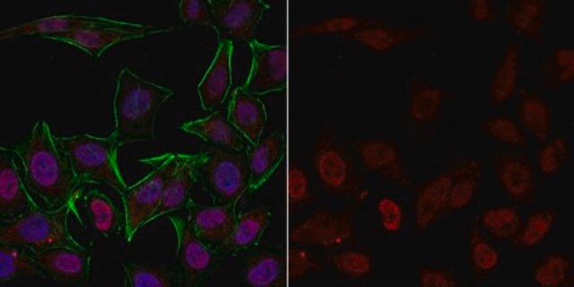 Anti-phospho-Histone H3 (Ser10) Antibody, clone 3H10, Alexa Fluor&#8482; 555 clone 3H10, from mouse, ALEXA FLUOR&#8482; 555