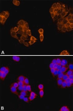 Anticorpo anti-paraoxonasi 1 (PON1) ~1&#160;mg/mL, affinity isolated antibody, buffered aqueous solution