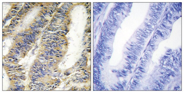 Anti-TNFA antibody produced in rabbit affinity isolated antibody