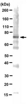 Anti-alpha-Synuklein, Oligomer-spezifischer Syn33-Antikörper from rabbit