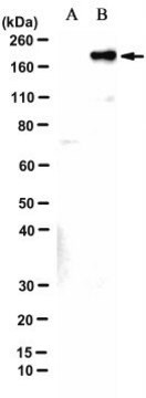 Anti-SARS-CoV-2 Delta Spike Antibody, P681R Antibody, clone 4C5-B2